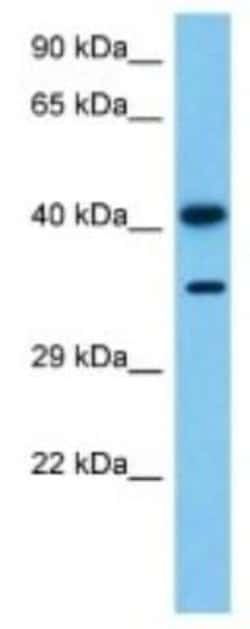 SERPINB1 Rabbit anti-Mouse, Polyclonal, Novus Biologicals 25 &mu;g | Buy Online | Novus Biologicals | Fisher Scientific